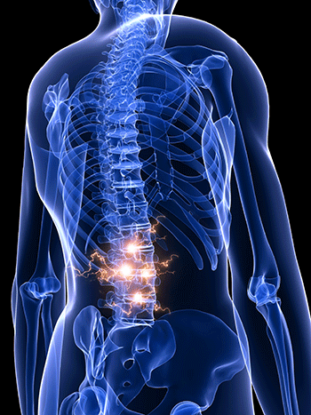 Chiropractic and back pain