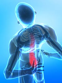 Chiropractic and sciatica