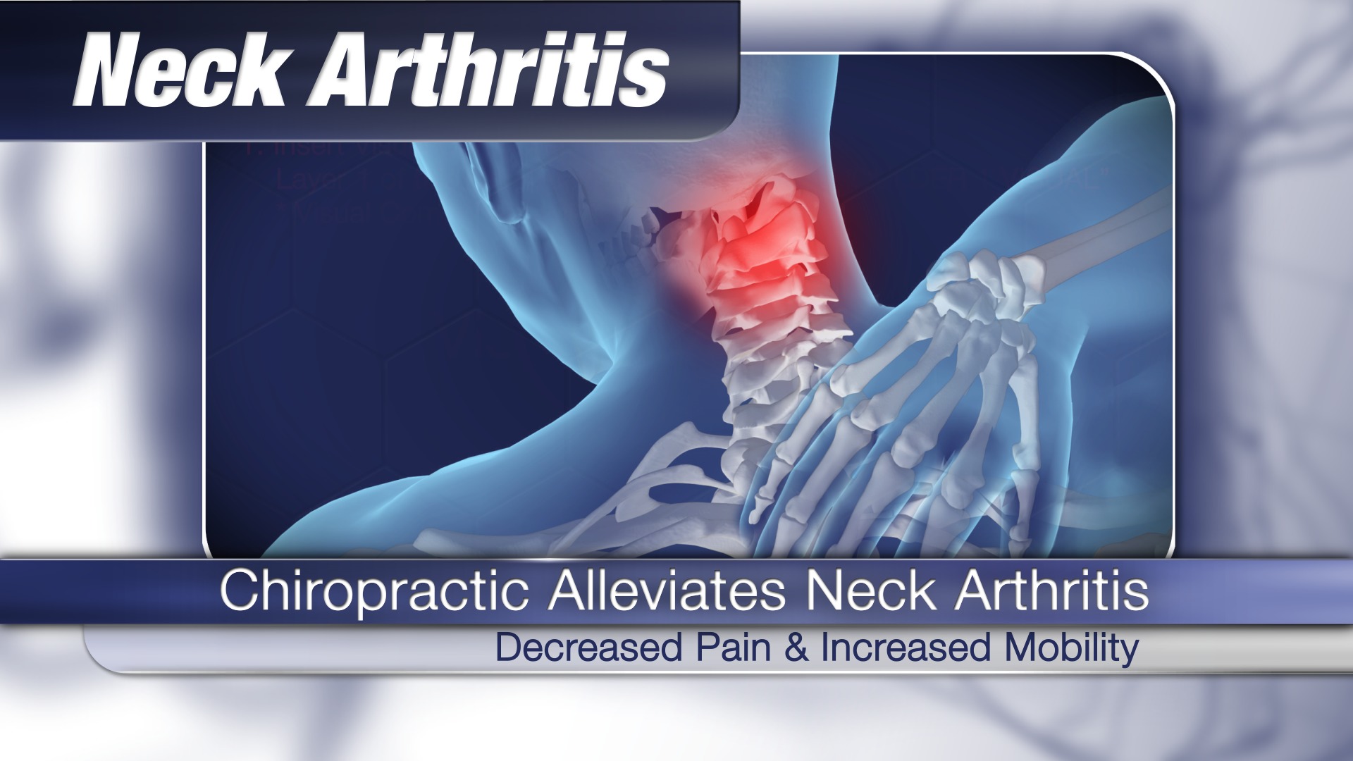 VIDEO Chiropractic Alleviates Neck Arthritis Chironexus News